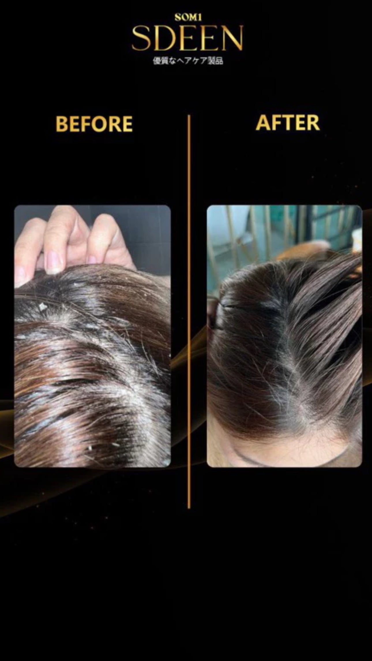 SDEEN HAIR GOALS KIT | Boost hair growth • Stop Hairfall